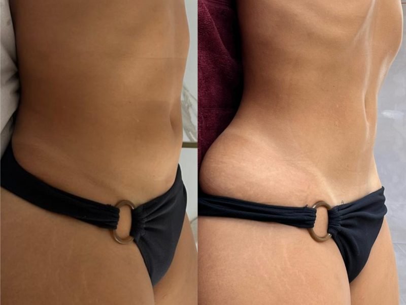 WhatsApp Image 2026-02-09 at 8.45.30 PM