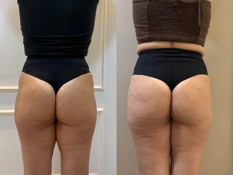 WhatsApp Image 2026-02-09 at 8.50.20 PM